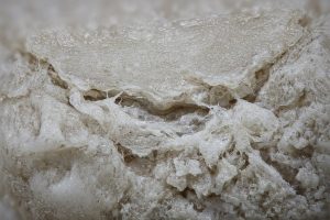 Артроз коленного сустава: что известно о причинах